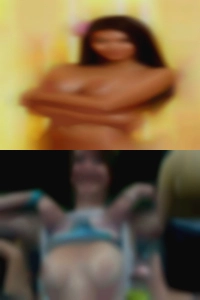 Burnt twice naked women hoping third is a charm.